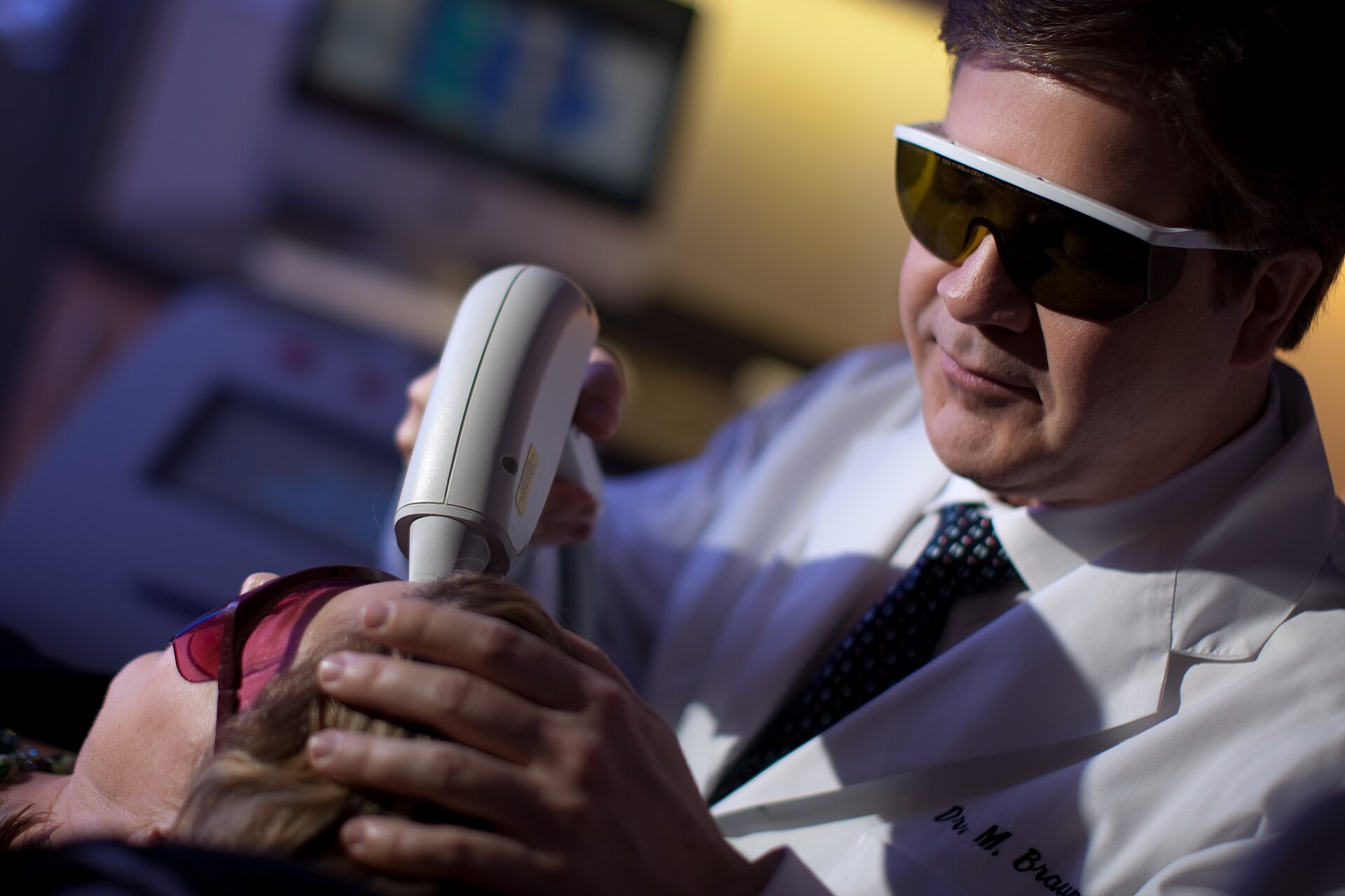 Clinician wearing protective eyewear applies a laser handpiece to a patient's face during a laser hair removal treatment.